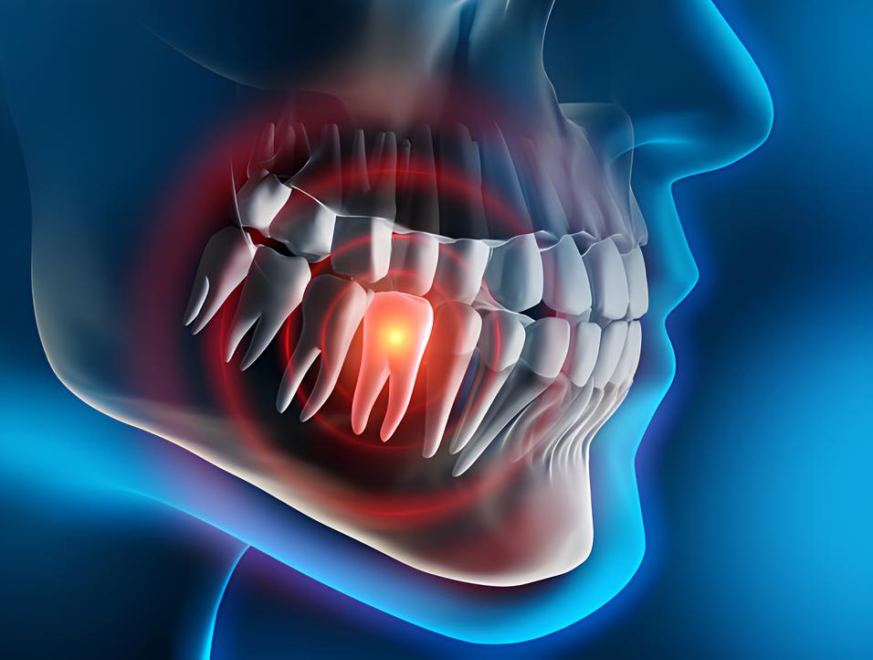 Teeth image - Emergency dentist Luton